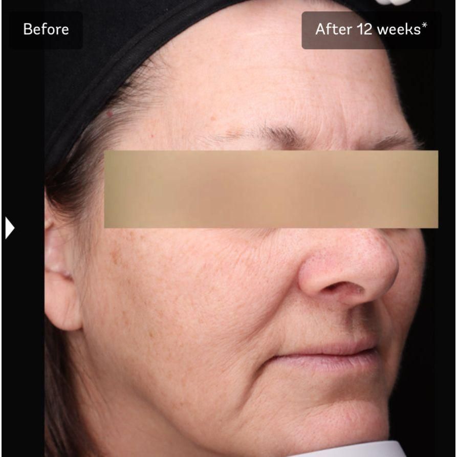 Vivier Brighten & Restore Program (2% HQ) *Special Order Product