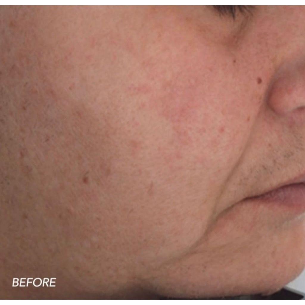 ZO Firming Serum