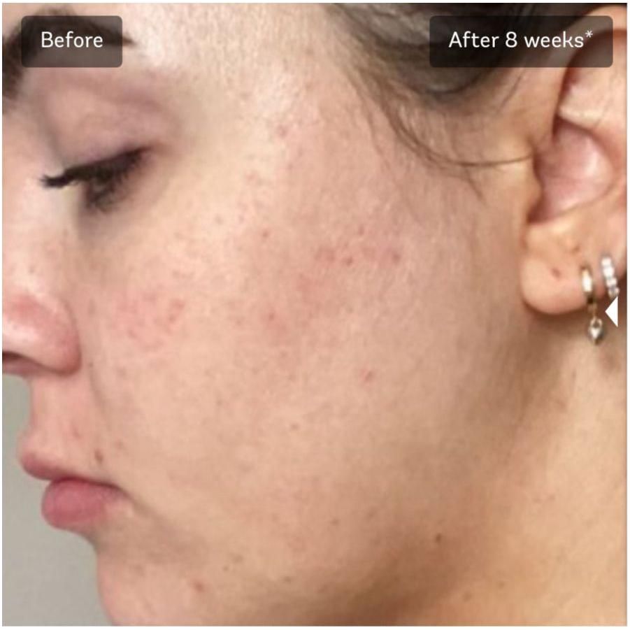 Vivier Advanced Skin Lightening Serum *Special Order Product