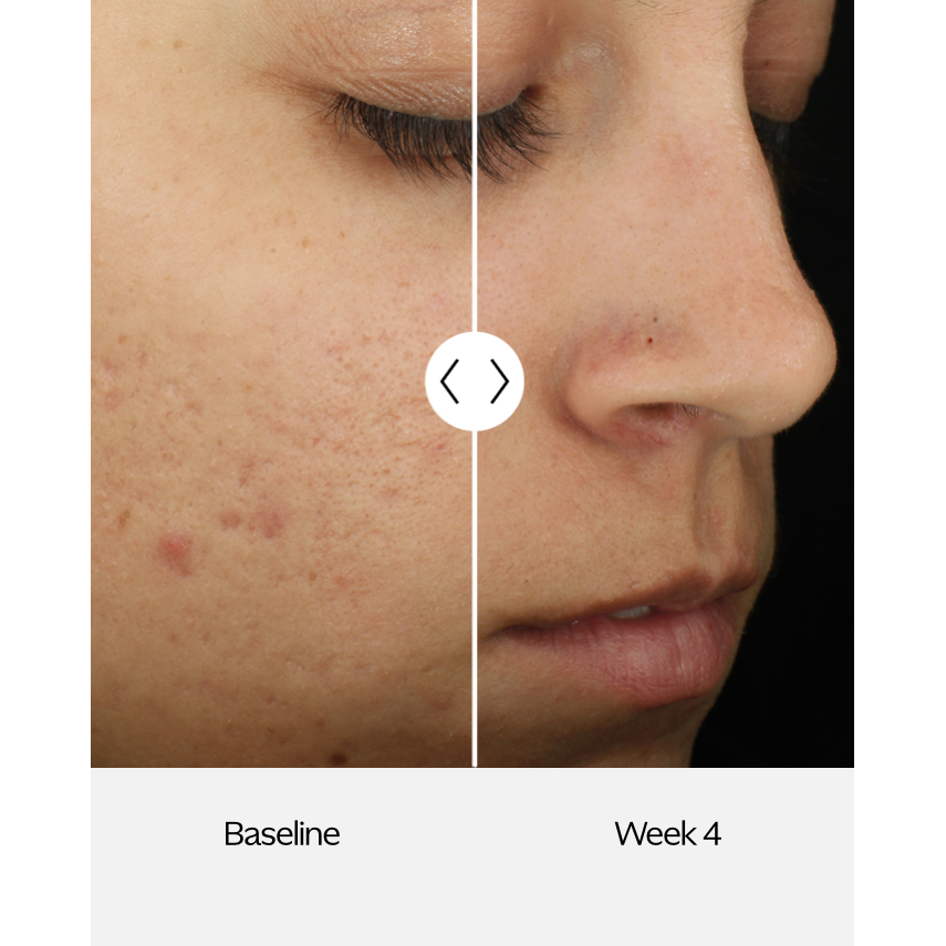 ZO Complexion Clarifying Serum