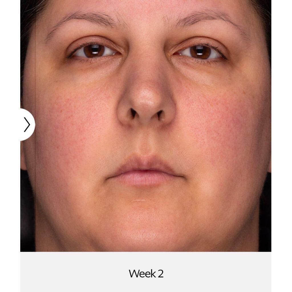ZO Recovery Creme