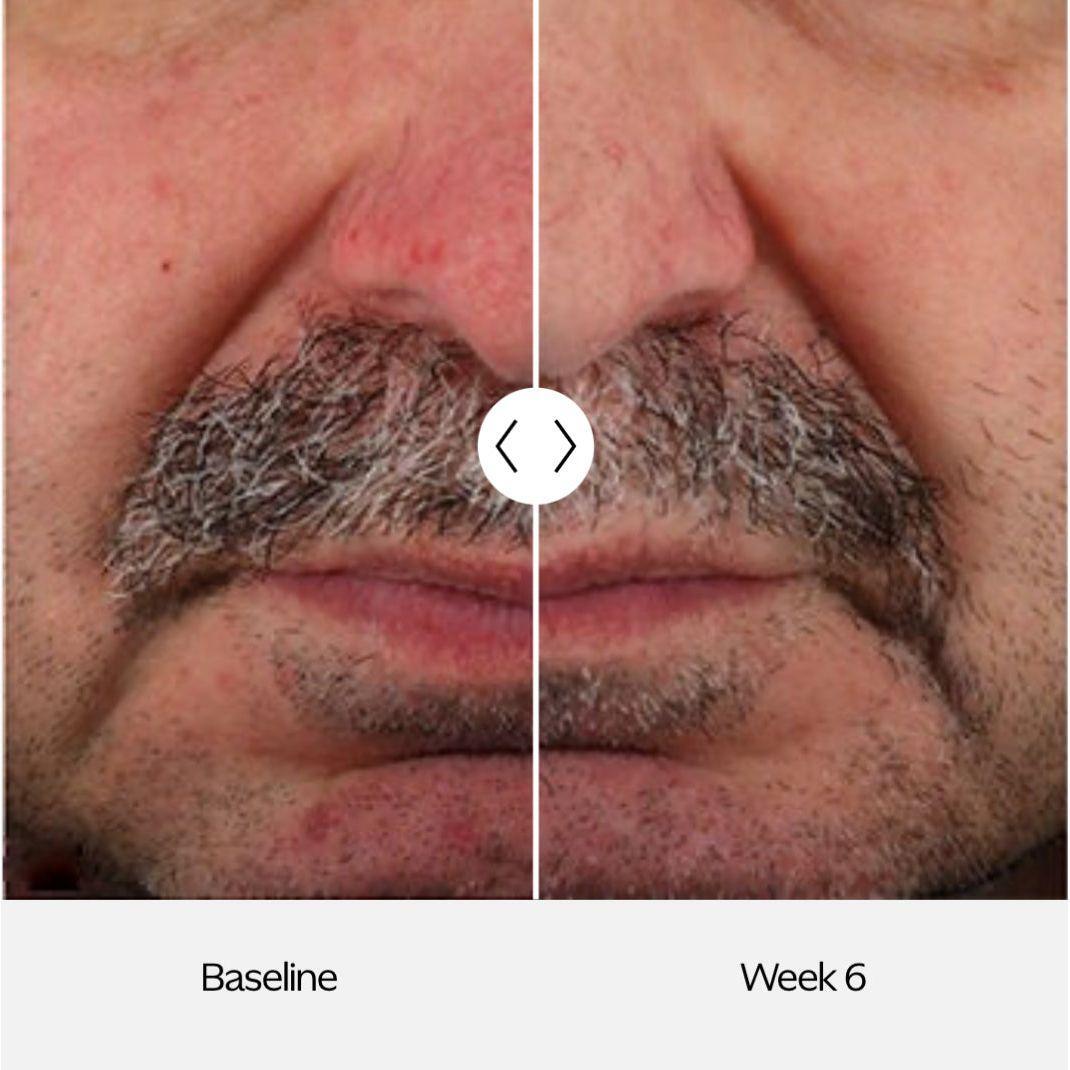 ZO Skin Normalizing System