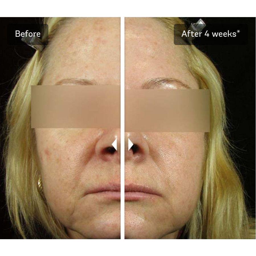 Vivier C E PEPTIDES