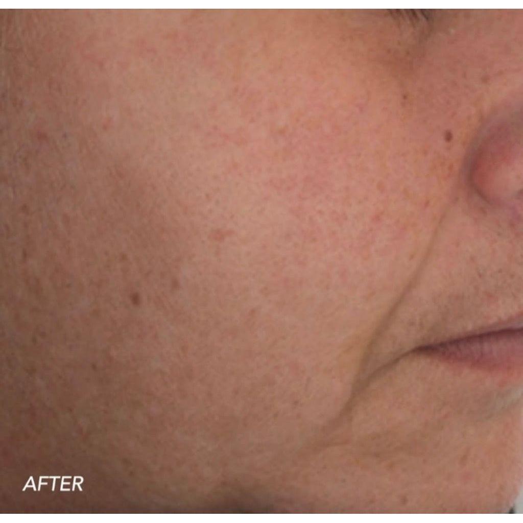 ZO Firming Serum
