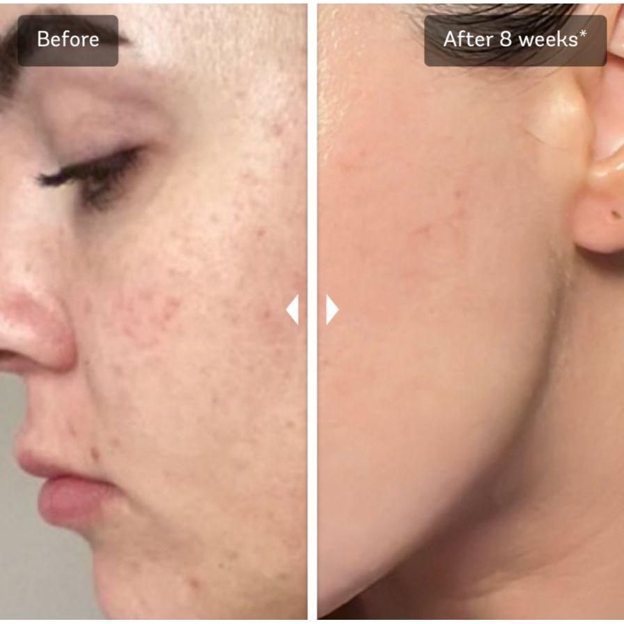 Vivier Advanced Skin Lightening Serum *Special Order Product
