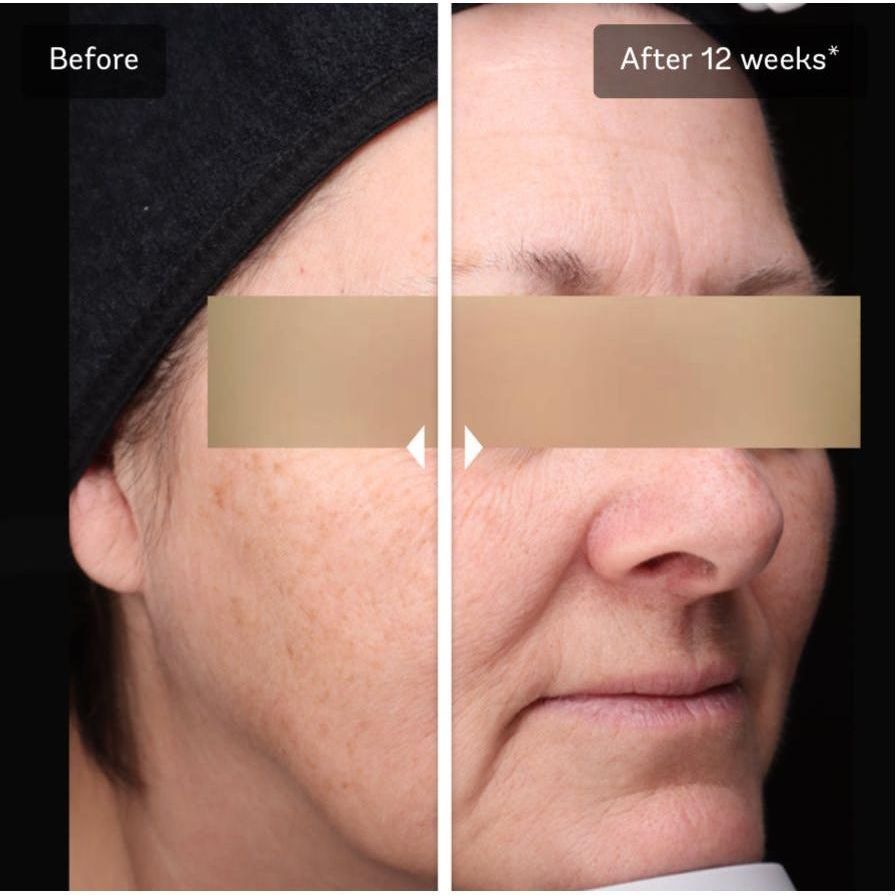 Vivier Brighten & Restore Program (2% HQ) *Special Order Product