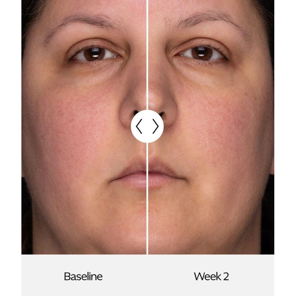ZO Recovery Creme