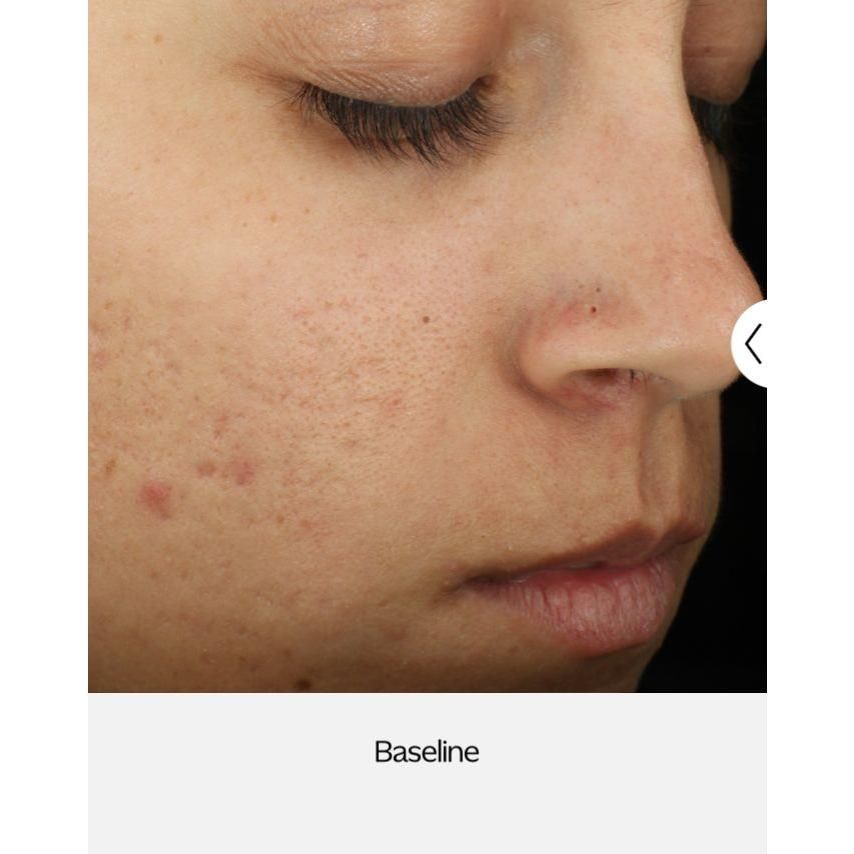 ZO Complexion Clarifying Serum