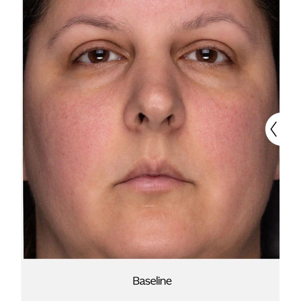 ZO Recovery Creme