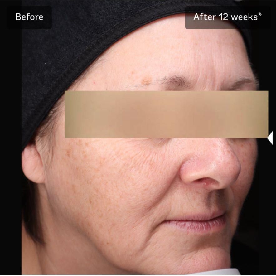 Vivier Brighten & Restore Program (2% HQ) *Special Order Product